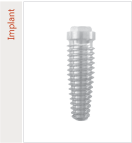Implant